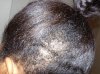 Hair Problem 004.jpg Hair Problem 004.jpg