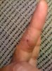 finger.jpg