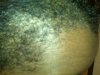 hairline1.jpg hairline1.jpg