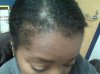 hairline2.jpg hairline2.jpg