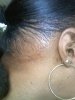 April 4-2010 right nape pic.JPG