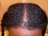 7 Months Post Progress 001.jpg