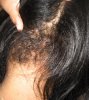 scalp 083.jpg