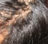 scalp 088.jpg