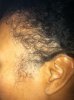 balding left side.JPG