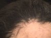 Scalp Damage010.jpg