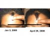 front legnth jan 08 vs apr 08.jpg