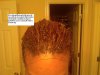 hairloss pic5.jpg