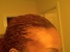 hairlosspic4.jpg