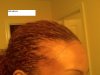 bald pic 2.jpg